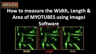 How to measure the Width Length and Area of Myotubes using ImageJ Software [upl. by Bobseine904]