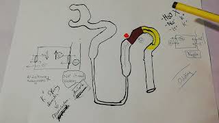 Distal tubule  Cortical collecting tubule  Principal cells  K sparing diuretics  spironolactone [upl. by Sauers]