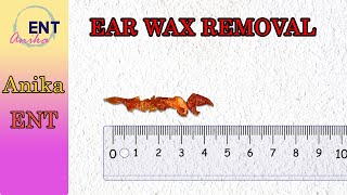 We Tested the Most Satisfying Ear Wax Removal Videos [upl. by Mayfield124]