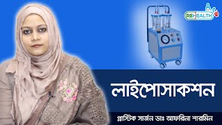 লাইপোসাকশন  Liposuction Procedure And Recovery [upl. by Okuy473]