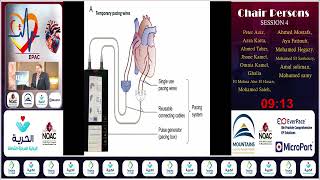 EPAC 24  S4  Early Postoperative Arrhythmia After Pediatric Cardiac Surgery  Dr Osama Abdelaziz [upl. by Anawyt]