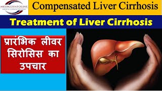 Treatment of liver cirrhosis  chronic liver disease  compensated cirrhosis [upl. by Amihsat251]