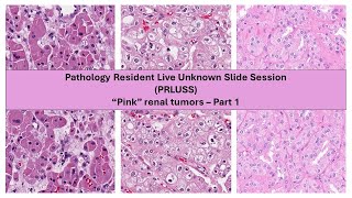 Pathology Resident Live Unknown Slide Session PRLUSS  Pink Renal Tumors Part 1 Pilot [upl. by Nnarual493]