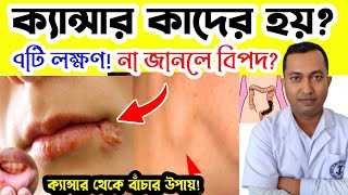 ক্যান্সার কাদের হয়😢 ক্যান্সারের গুরুত্বপূর্ণ ৭টি লক্ষণ না জানলেই বিপদ  cancer sign symptoms [upl. by Oiramel14]