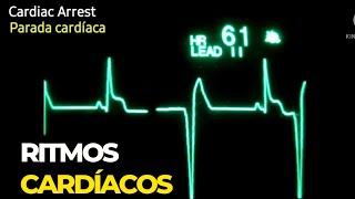 ECG EKG Ritmos cardíacos letales sinusal taquicardia bradicardia fibrilação parada cardíaca [upl. by Burbank]