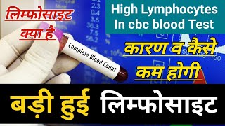 High Lymphocytes In Blood Test Causes Treatment  high lymphocytes in hindi लिम्फोसाइट्स क्या है [upl. by Akimaj223]