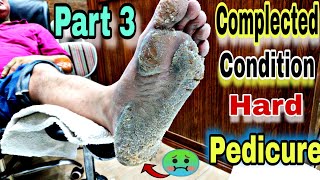 Pedicure Complected Condition of Foot Part3🔥 Footcare33 [upl. by Eetse]