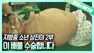 2부 부푼 배를 안고 산 9살 상진이 과연 수술 결과는┃9YearOld with a Seriously Swollen Belly and After the Operation [upl. by Peatroy]