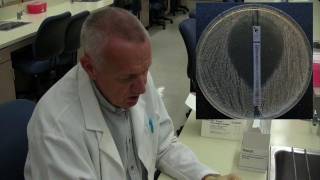 Etest for antibiotic susceptibility [upl. by Martelli56]