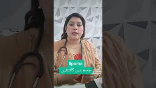 Lipoma and its homeopathic medicine by dr hafsa haider homeo physican [upl. by Ellegna]