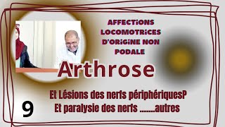 Larthrose  lesions des nerfs périphériques [upl. by Algernon]