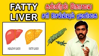 கல்லீரல் நோய சரிசெய்ய கீழாநெல்லிய இந்த மாதிரி சாப்பிடுங்க  Keezhanelli cure Fatty Liver Disease [upl. by Kenlay43]