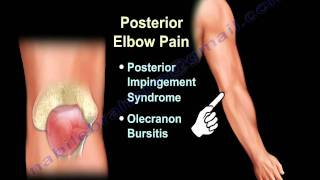 ELBOW PAIN  COMMON CAUSES  Everything You Need To Know  Dr Nabil Ebraheim [upl. by Bean]