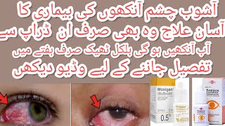 Moxigan amp femicon eye drops uses in urdu l best for eyes infection and itching by aneespharmacist [upl. by Jacynth]