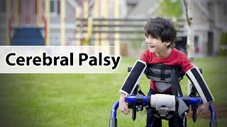 What is Cerebral Palsy [upl. by Alsworth]