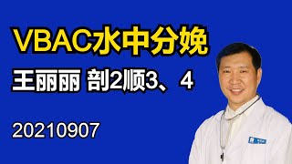 VBAC 剖后顺产程及产后 王丽丽 剖2顺3、4 [upl. by Subocaj]