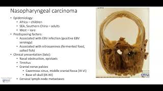 Nasopharynx Nasopharyngeal carcinoma Gross pathology [upl. by Meli]