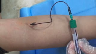 Phlebotomy：Butterfly Needle Blood Draw [upl. by Byers]