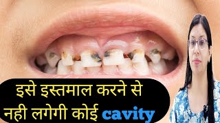 बच्चो के दांतों को cavity लगने से कैसे बचाये  Fluoride Treatment  How to prevent cavities [upl. by Alleirbag]