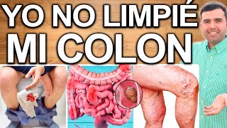 CONSECUENCIAS DE NO LIMPIAR TU COLON  Enfermedades Por Colon Sucio [upl. by Luy]