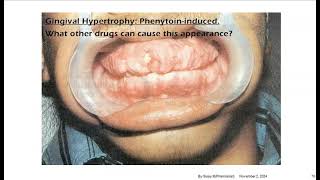 Antiepileptic DrugsCNS Drug [upl. by Miru]