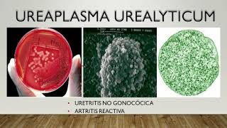 Ureaplasma Enfermedades Transmisibles [upl. by Arabeila]