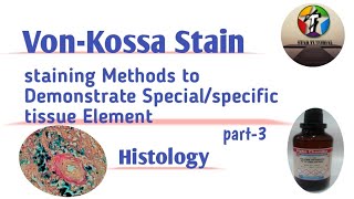 VonKossa Stain ll Staining Methods to Demonstrate Special or specific tissue element ll Histology [upl. by Cthrine]