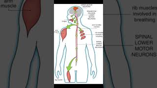 What is amyotrophic lateral sclerosis ALS health healthcare disease viraldisease [upl. by Gaskin]