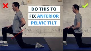 6 Minute Routine to Correct ANTERIOR Pelvic Tilt [upl. by Proudman720]