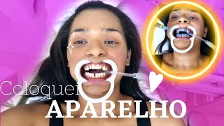 VLOGColocando Aparelho nos dentes Nathy Soares [upl. by Perron]