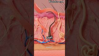 What is ingrown hair 😱 shorts [upl. by Ilatan]