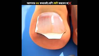 ভুলেও কখনো নখ ছোট করবেন না ❌ Stop Cutting Your ToeNail Like This ⚠️ shorts viral trending [upl. by Leruj]