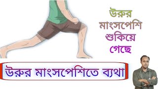 উরুর ব্যথা কমানোর চিকিৎসা। রানের ব্যথা কমানোর উপায়।Thigh pain [upl. by Notniv429]