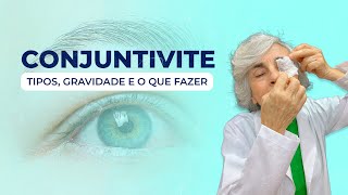 Conjuntivite gravidade tipos e o que fazer [upl. by Batista]