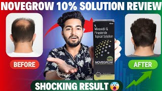 Novegrow 10 Minoxidil Solution Review  Minoxidil Finasteride Solution Added With Capixyl [upl. by Zohar490]