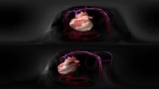 Myocardial Infarction 360 [upl. by Niraj414]