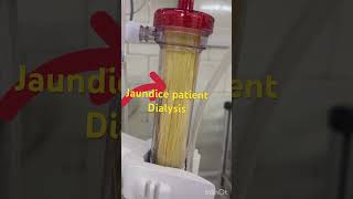 Jondice patient का डायलिसिस होने के बाद कैसे हो जाती है dialyzer dialysis kaise hota haidialysis [upl. by Hnoj]