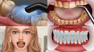 ASMR Mouth Cleaning  Get rid of bad breath  tonsil stones removal salivary glands cleaning [upl. by Nevile]