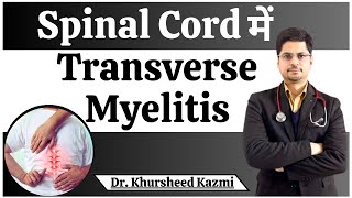 Spinal cord में Transverse Myelitis  Transverse Myelitis Treatment in Delhi  Dr Khursheed Kazmi [upl. by Mathe]