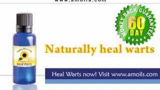 Warts Treatment Wart Removal [upl. by Neffets]