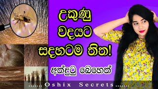 උකුණු වදයට සදහටම තිතඅත්දුටු බෙහෙත්How to remove head lice [upl. by Crudden]