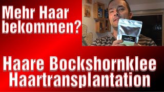 Bockshornklee Nach Haartransplantation Erfahrung Franky Haare Medical Exclusive Türkei [upl. by Esiuol773]