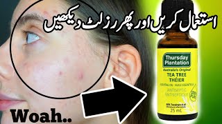 Skin Care routine best home remedies for daily skin whitening tips [upl. by Agni]