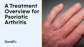 A Treatment Overview for Psoriatic Arthritis  GoodRx [upl. by Melicent]