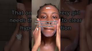 How to fade hyperpigmentation FAST [upl. by Nigen399]