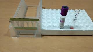 Indirect Coombs test by CAT method [upl. by Lindemann501]