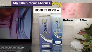 Jenpharm MandelAC Face wash Honest Review [upl. by Yeo210]