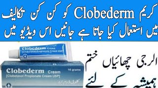 clobederm cream uses in Urdu  clobederm nn ointment uses  clobederm s lation uses  clobederm crea [upl. by Nnilsia]