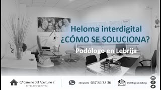 HELOMA INTERDIGITAL ¿CÓMO SE SOLUCIONA 👣😷👍 heloma anestesia podólogo pie [upl. by Amena207]