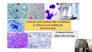 Tumor of infancy amp childhood [upl. by Pirozzo]